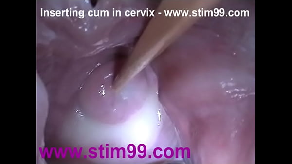 Inven Semen Cum en un gran cuello uterino dilatado